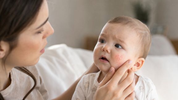 Reconnaître et gérer les allergies fréquentes chez les nourrissons